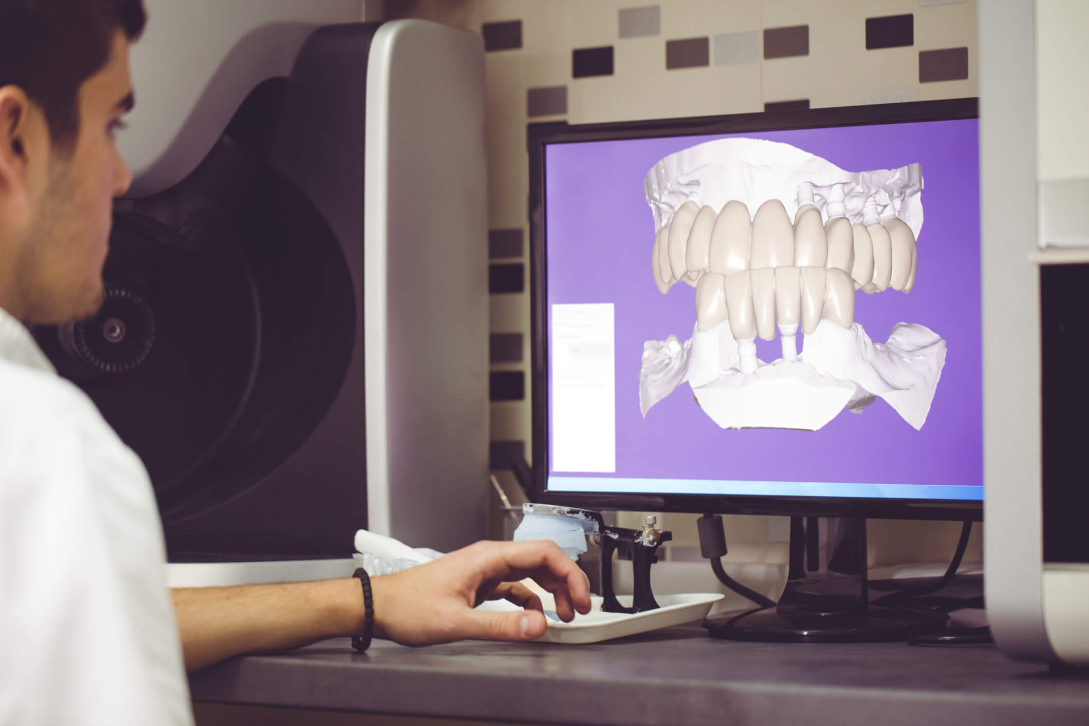 Leia mais sobre o artigo Inovação na odontologia: tudo o que você precisa saber!