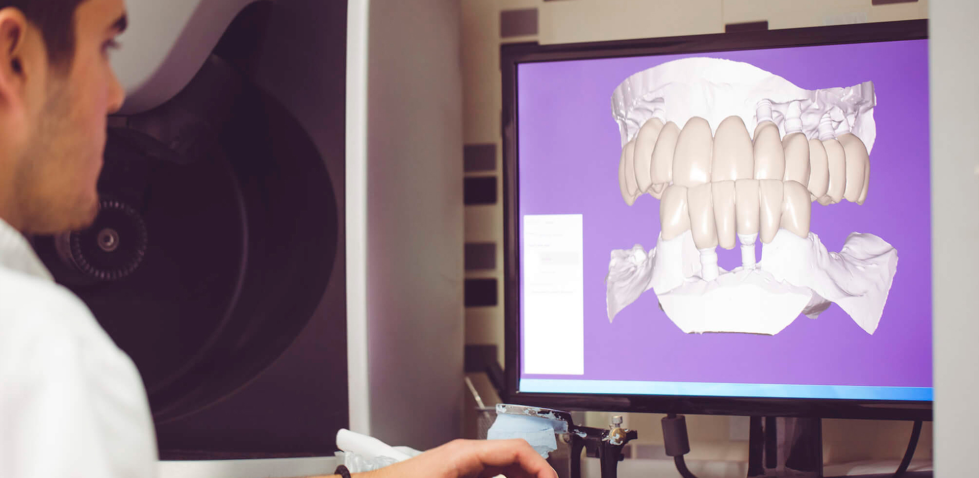 Leia mais sobre o artigo Inovação na odontologia: tudo o que você precisa saber!