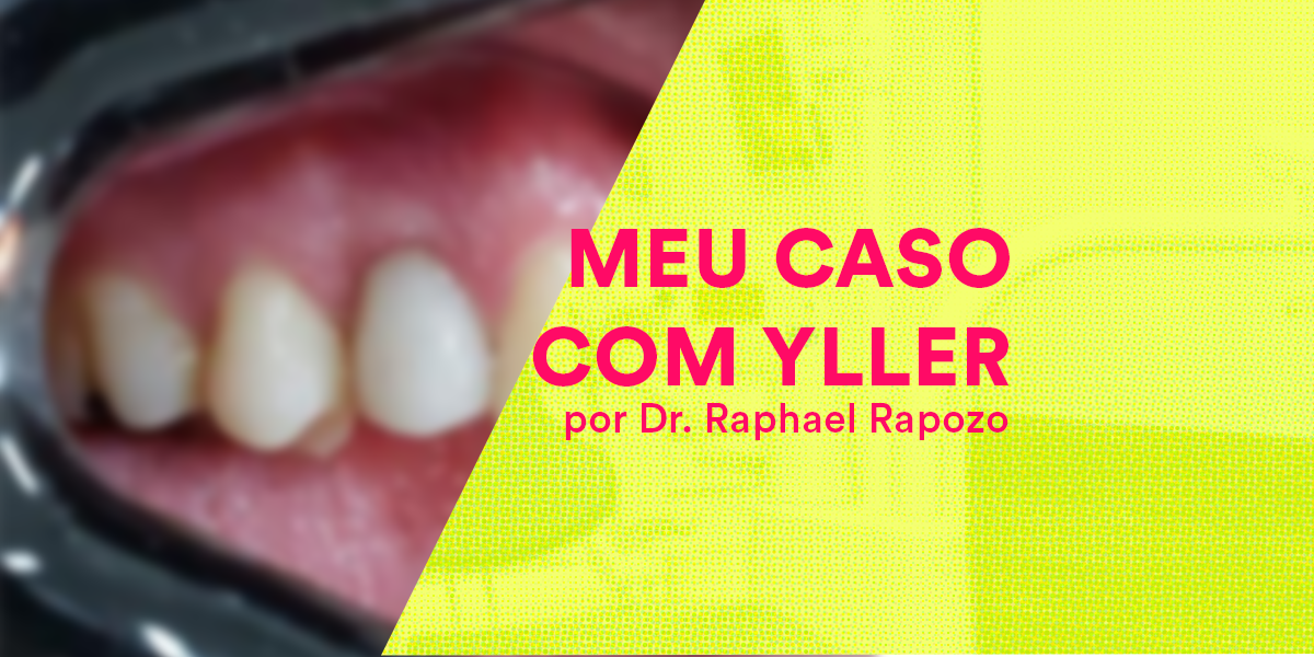 Leia mais sobre o artigo Caso Clínico Dr. Raphael Rapozo