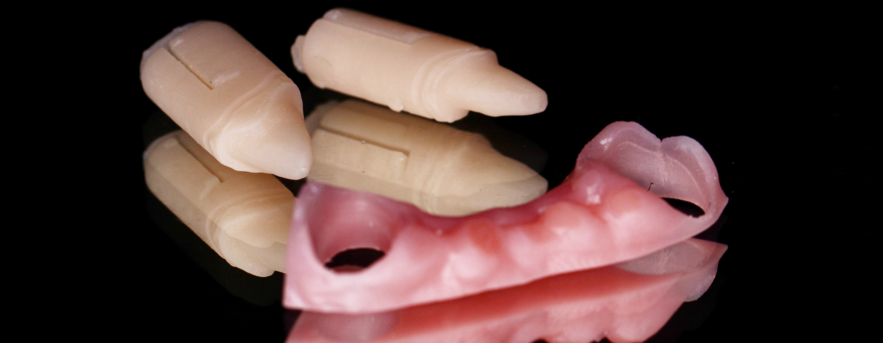 Leia mais sobre o artigo Caso clínico: Coroa inferior sobre dentes