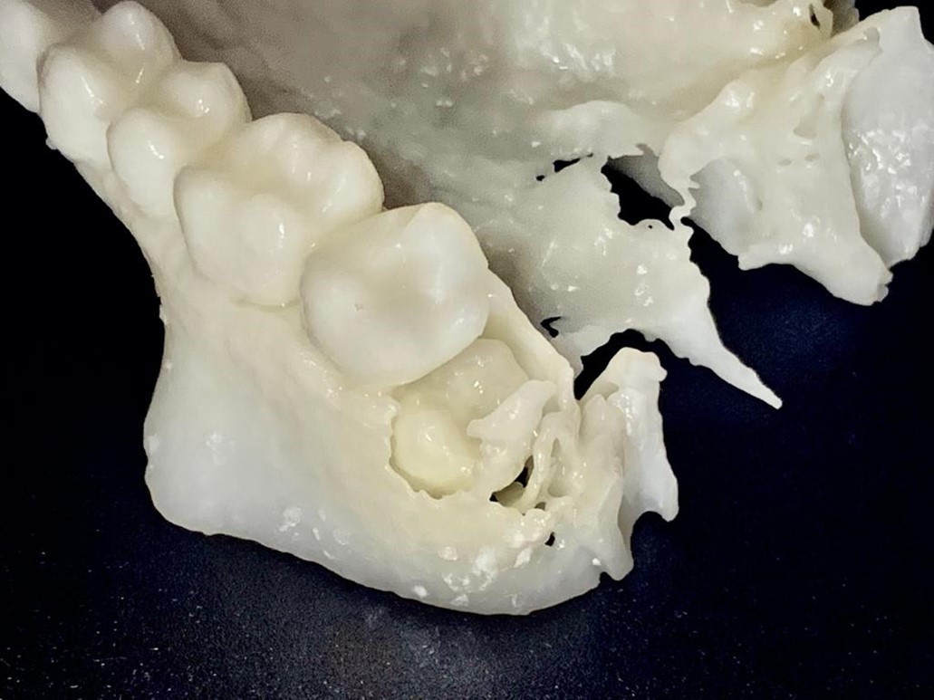 Leia mais sobre o artigo A impressão 3D pode contribuir com a educação e o dia-a-dia da clínica odontológica?